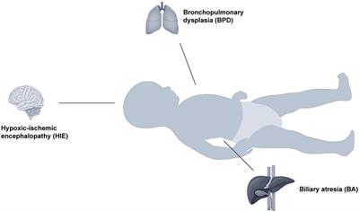 Telomere dysfunction in some pediatric congenital and growth-related diseases